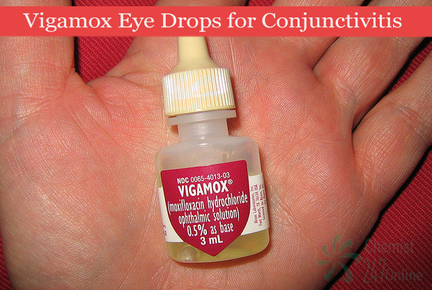 Coupons vigamox eye drops