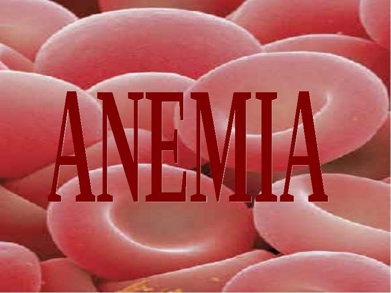 Включи анемия. Железодефицитная анемия рисунок. Надпись железодефицитной анемии. Профилактика железодефицитной анемии.