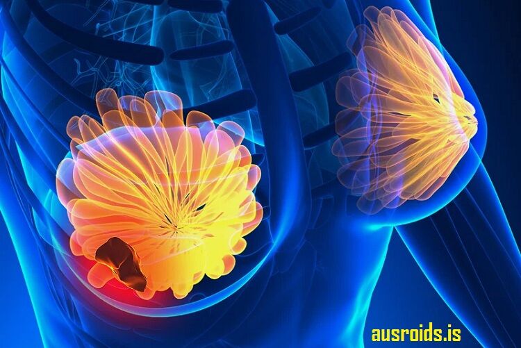 Where To Buy Nolvadex Australia