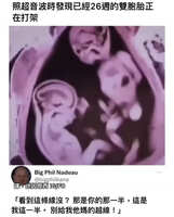 https://images.plurk.com/3zTiUNEMgLEZzmdOPKcqLj.jpg