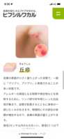 https://images.plurk.com/6EwkTPiiqHcwgd77f7ZcO4.png
